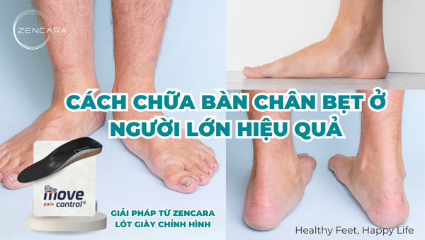 Cách chữa bàn chân bẹt ở người lớn hiệu quả