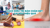 Cách điều trị bàn chân bẹt tại nhà hiệu quả qua các bài tập và mẹo cải thiện dáng vòm chân