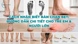 Cách nhận biết bàn chân bẹt: Hướng dẫn chi tiết cho trẻ em & người lớn