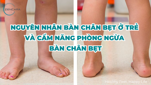 Nguyên nhân bàn chân bẹt ở trẻ và cẩm năng phòng ngừa bàn chân bẹt