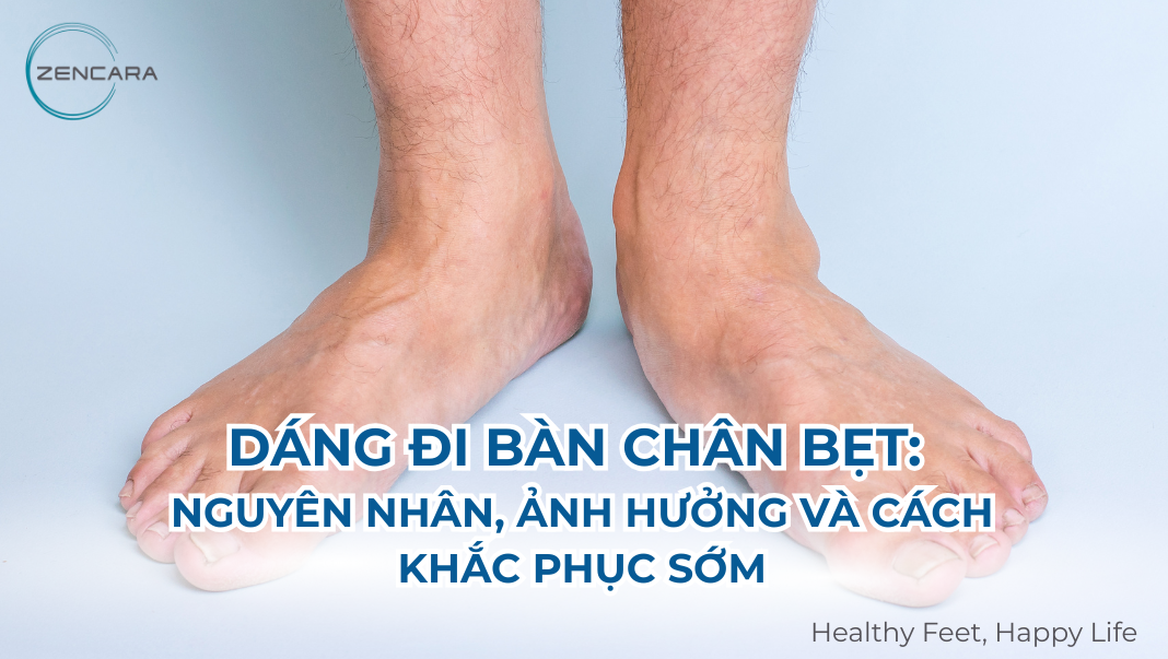 Dáng đi bàn chân bẹt: Nguyên nhân, ảnh hưởng và cách khắc phục sớm