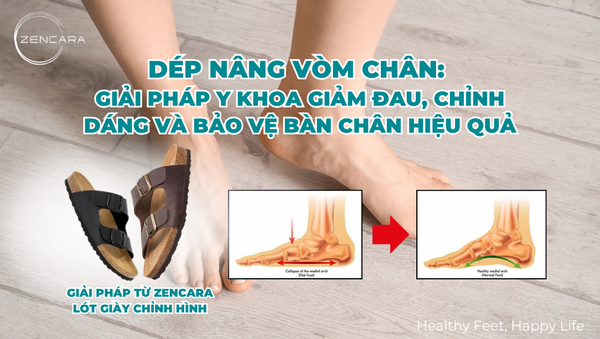 Dép nâng vòm chân: Giải pháp y khoa giảm đau, chỉnh dáng và bảo vệ bàn chân hiệu quả