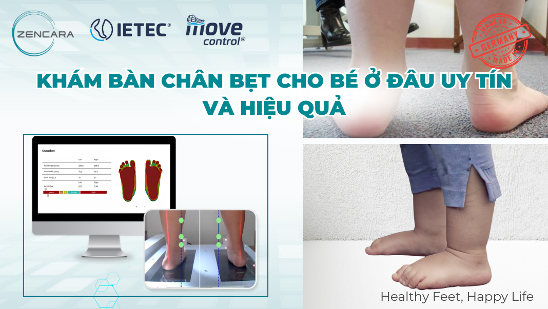 Khám bàn chân bẹt cho bé ở đâu uy tín và hiệu quả