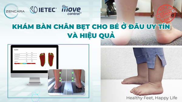 Khám bàn chân bẹt cho bé ở đâu uy tín và hiệu quả