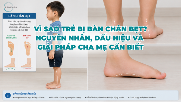 Vì sao trẻ bị bàn chân bẹt? Nguyên nhân, dấu hiệu và giải pháp cha mẹ cần biết
