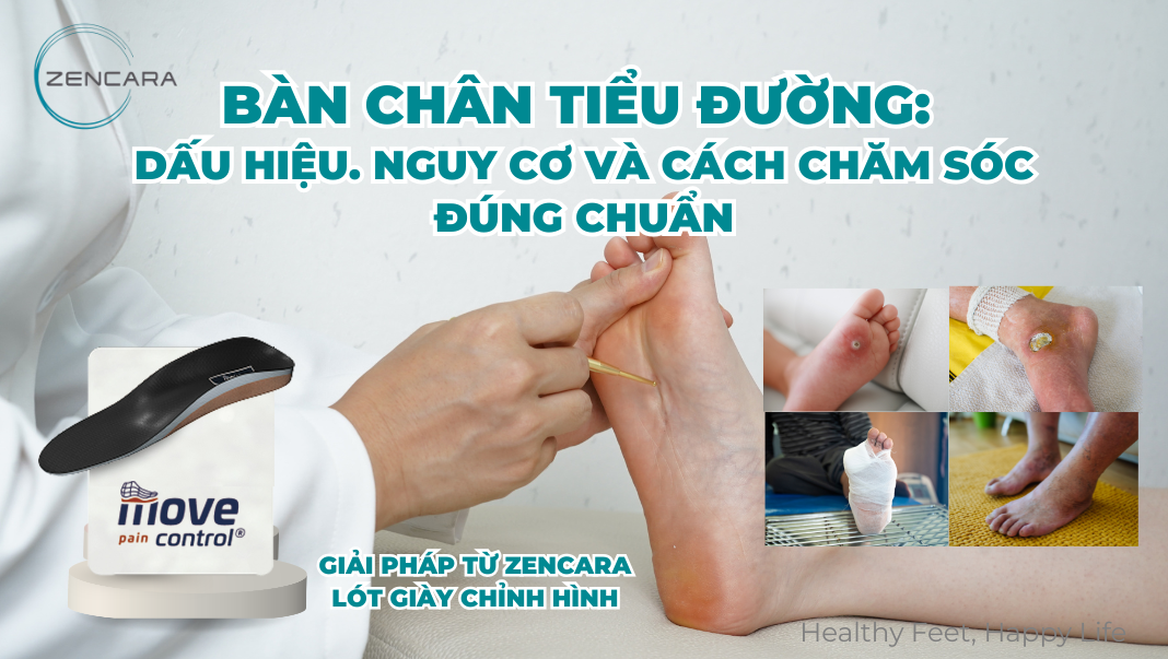 Bàn chân tiểu đường: Dấu hiệu. nguy cơ và cách chăm sóc đúng chuẩn