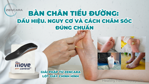 Bàn chân tiểu đường: Dấu hiệu. nguy cơ và cách chăm sóc đúng chuẩn