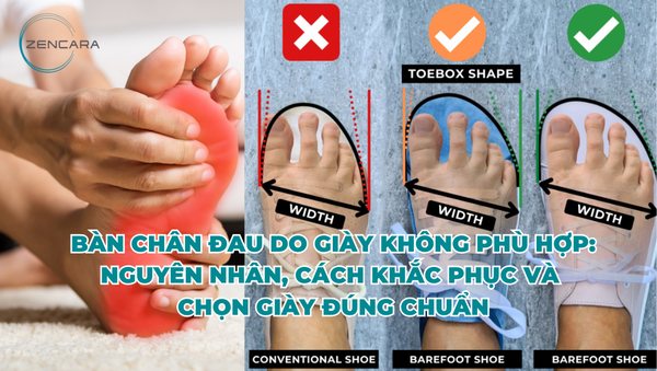 Bàn chân đau do giày không phù hợp: Nguyên nhân, cách khắc phục và chọn giày đúng chuẩn
