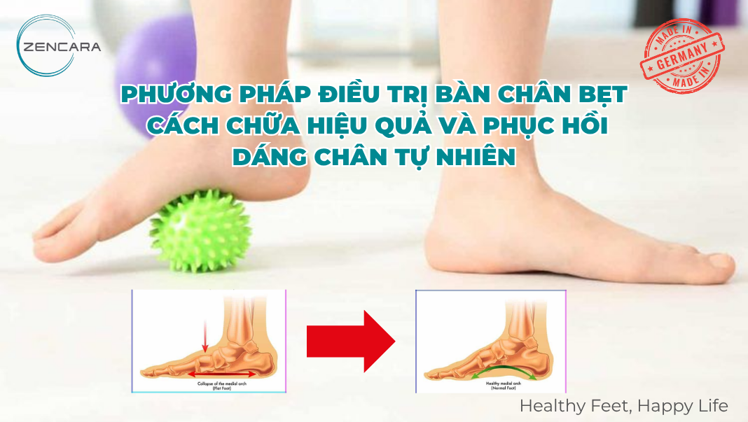 Phương pháp điều trị bàn chân bẹt: Cách chữa hiệu quả và phục hồi dáng chân tự nhiên