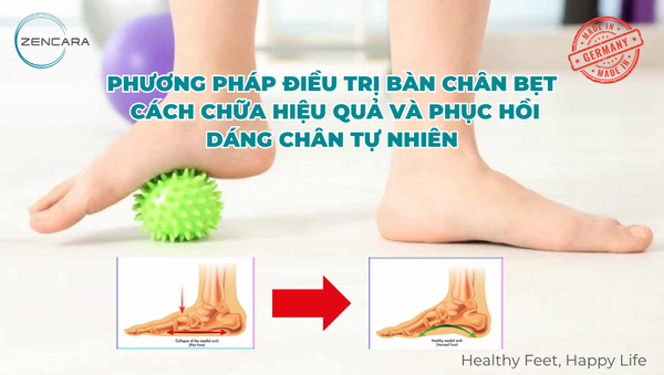 Phương pháp điều trị bàn chân bẹt: Cách chữa hiệu quả và phục hồi dáng chân tự nhiên