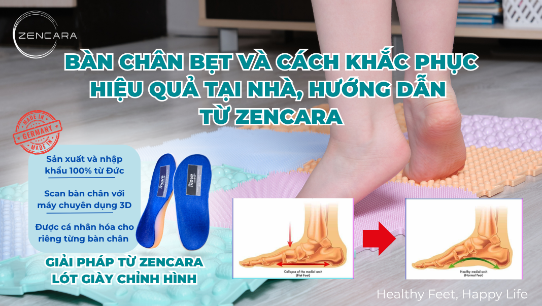 Bàn chân bẹt và cách khắc phục hiệu quả tại nhà, hướng dẫn từ Zencara