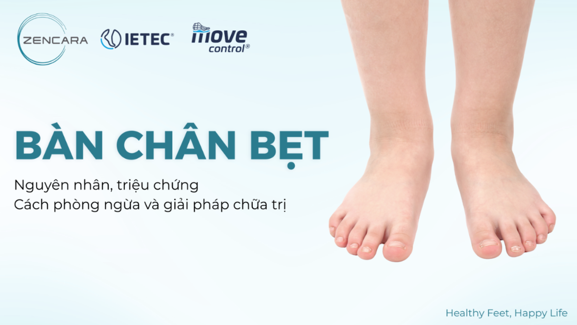 Bàn chân bẹt là gì? Nguyên nhân, triệu chứng và cách chữa trị