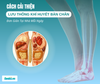 Cách Cải Thiện Lưu Thông Khí Huyết Bàn Chân Đơn Giản Tại Nhà Mỗi Ngày