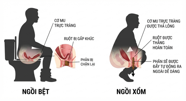 Bồn Cầu Ngồi Xổm: Phân Tích Chuyên Sâu Lợi Ích Sức Khỏe Và Kỹ Thuật Chế Tác Sứ