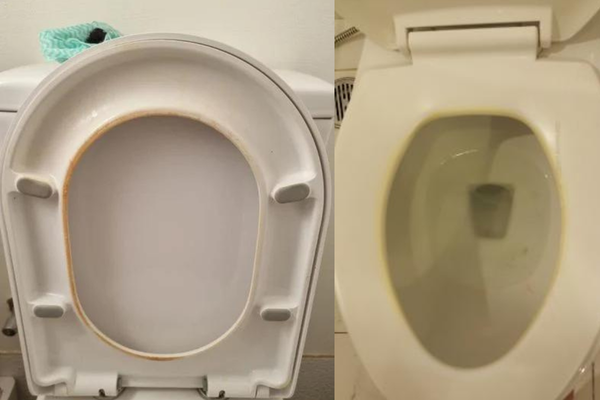 Cách Tẩy Bồn Cầu Bị Đen Hiệu Quả & Giải Pháp Chống Ố Vàng
