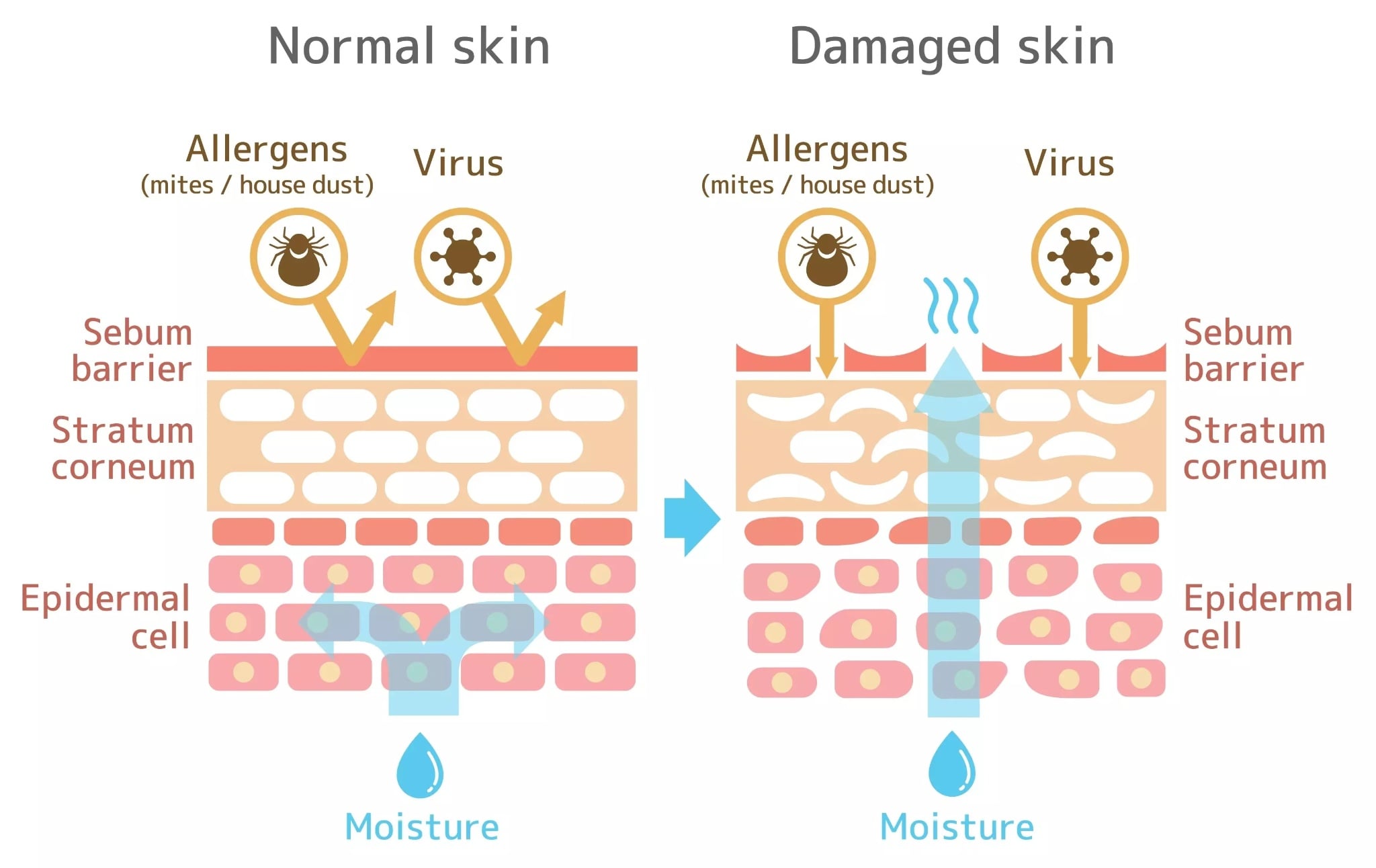 Công thức Ceramide 3:1:1 có thực sự là “tỷ lệ vàng” phục hồi da?