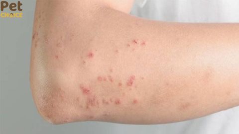 Cảnh giác với những dấu hiệu bị sán chó mèo cần kiểm tra ngay