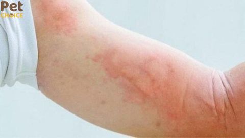 Nuôi mèo có bị sán không? Những dấu hiệu bị sán mèo cần chú ý