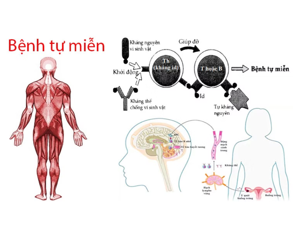 Miễn Dịch Quá Mạnh Có Gây Hại Không? | Theo PGS.TS.Bs Lê Xuân Hải
