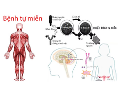 Miễn Dịch Quá Mạnh Có Gây Hại Không? | Theo PGS.TS.Bs Lê Xuân Hải