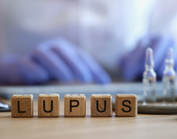 Vai Trò Của Tế Bào Tua (DC) Trong Bệnh Lupus Ban Đỏ Hệ Thống | Theo PGS.TS.BS Lê Xuân Hải