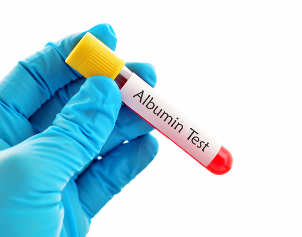Chỉ Số Albumin Thấp Có Nguy Hiểm Không? | Theo PGS.TS.BS Lê Xuân Hải