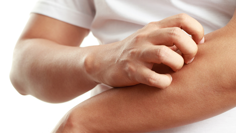 Ngứa là gì? Giải mã nguyên nhân gây bệnh và nguyên tắc phòng ngừa dứt điểm