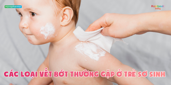 Các loại vết bớt thường gặp ở trẻ sơ sinh – khi nào bình thường, khi nào cần lo?