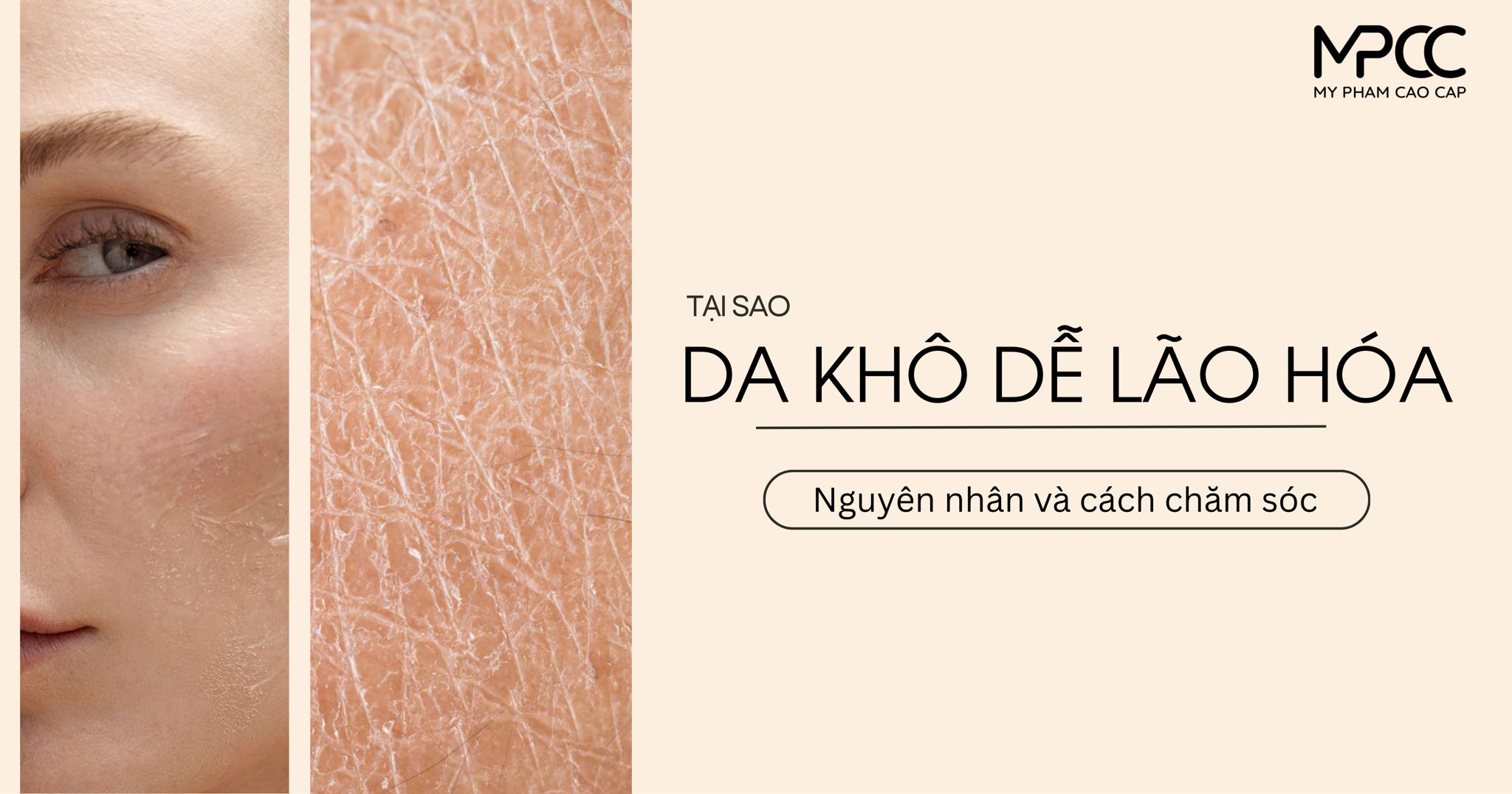 Da khô dễ lão hóa: Nguyên nhân, dấu hiệu và cách chăm sóc giúp da trẻ lâu