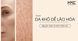Da khô dễ lão hóa: Nguyên nhân, dấu hiệu và cách chăm sóc giúp da trẻ lâu