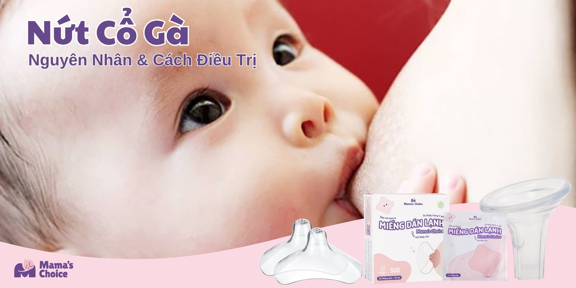 Nứt Cổ Gà: Nguyên Nhân & Cách Điều Trị Dứt Điểm Trong 3 Ngày