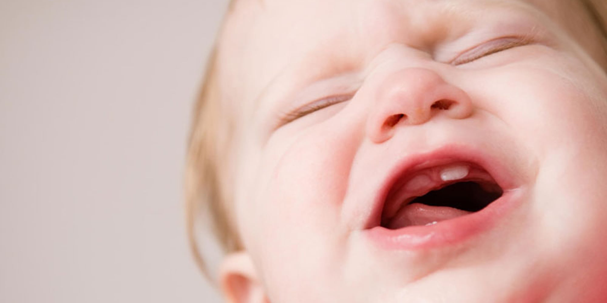 Bé Mọc Răng Hay Bị Sốt Nhẹ Và Biếng Ăn