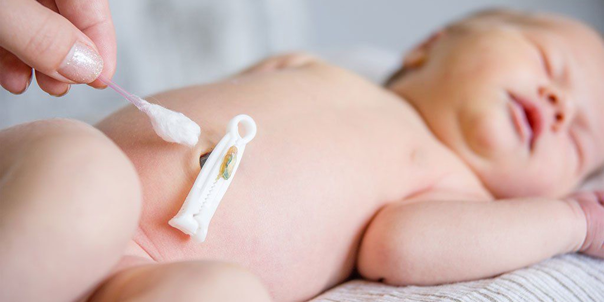 Cách Vệ Sinh Rốn Cho Trẻ Sơ Sinh Đơn Giản, An Toàn