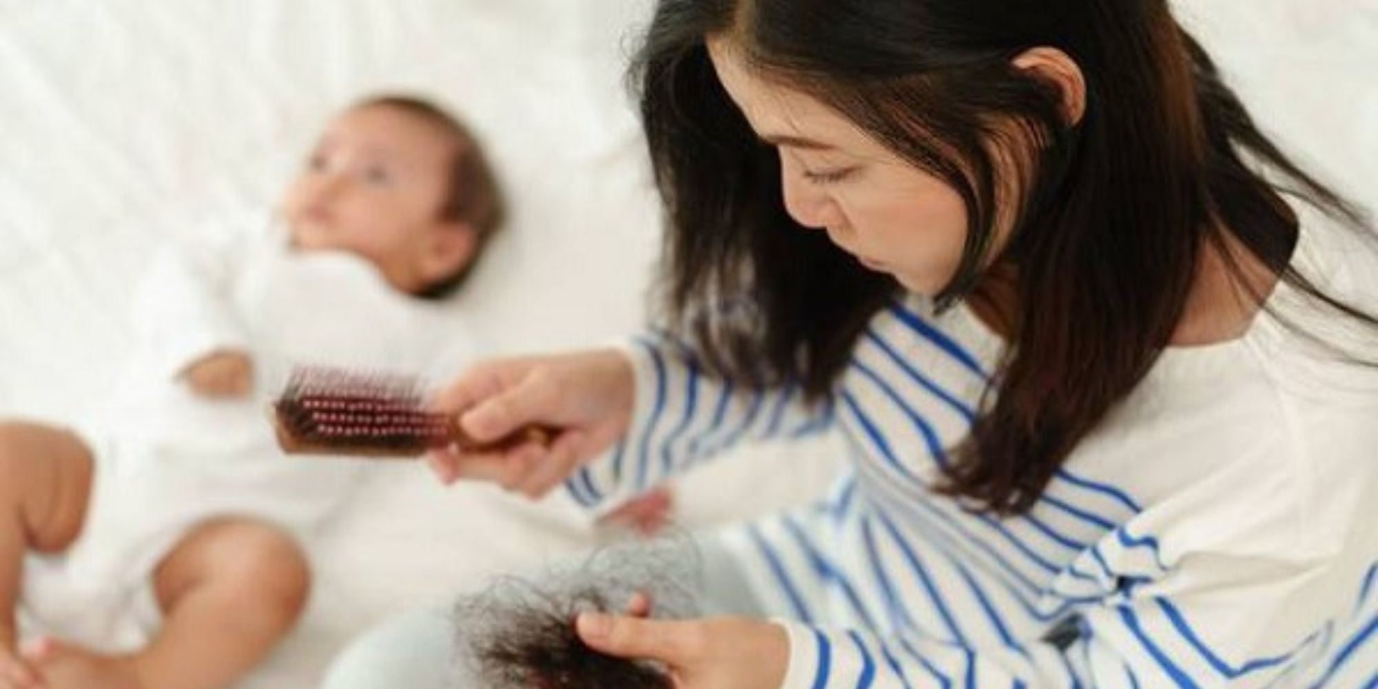 Rụng Tóc Sau Sinh Và Thiếu Hụt Dinh Dưỡng