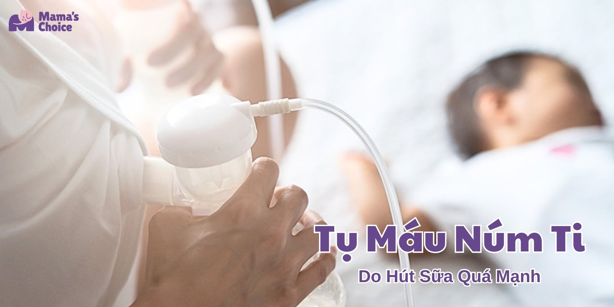 Tụ Máu Núm Ti Do Hút Sữa Quá Mạnh