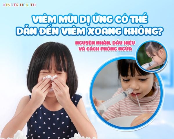 VIÊM MŨI DỊ ỨNG CÓ THỂ DẪN ĐẾN VIÊM XOANG KHÔNG? NGUYÊN NHÂN, DẤU HIỆU VÀ CÁCH PHÒNG NGỪA