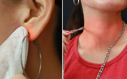 Bạc Bị Kích Ứng Da Bé: Khi Nào Mẹ Cần Tháo Vòng Ra Ngay Lập Tức?