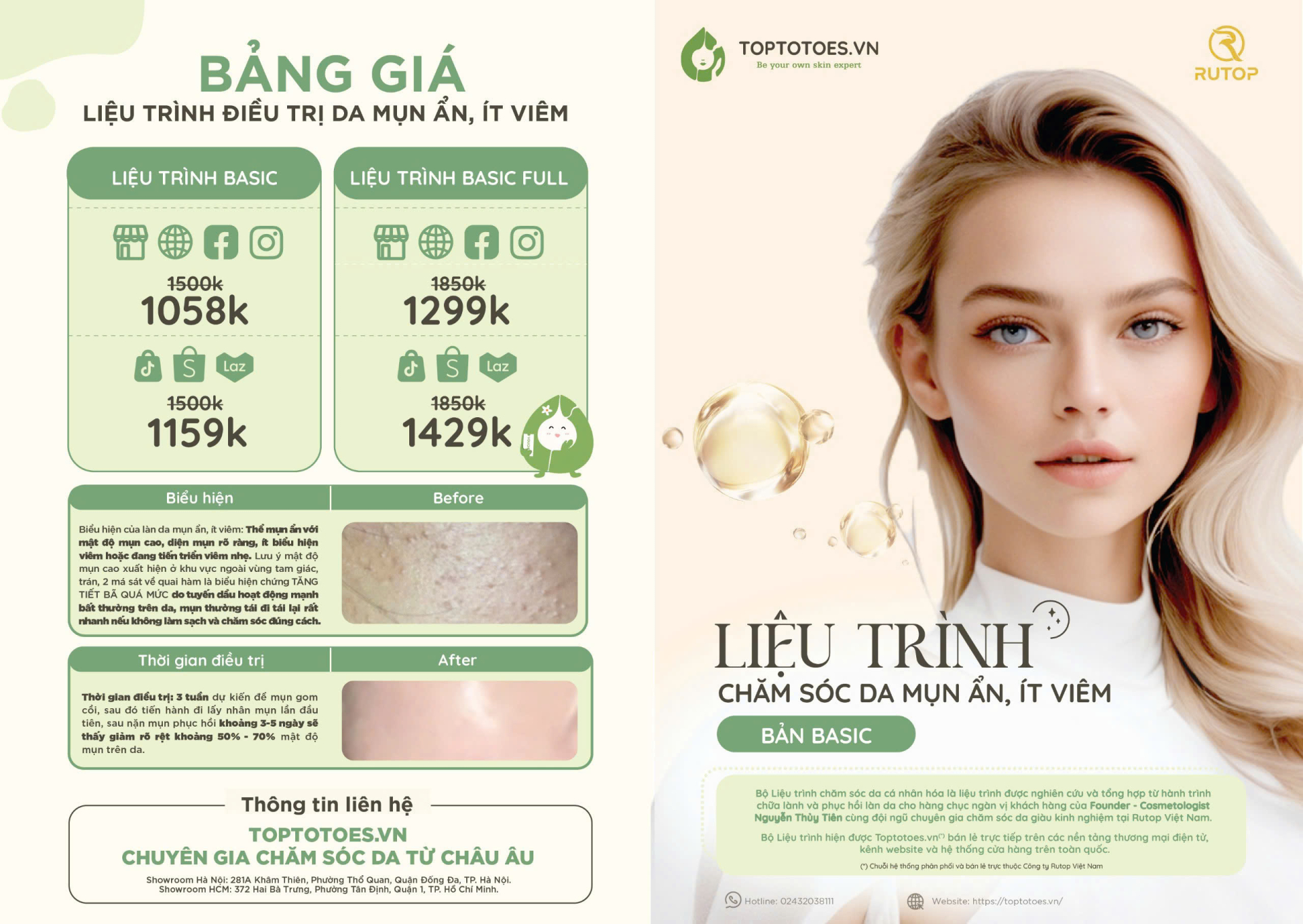 Toptotoes.vn khẳng định vị thế khác biệt trong hành trình chăm sóc da với Liệu trình chăm sóc da cá nhân hóa
