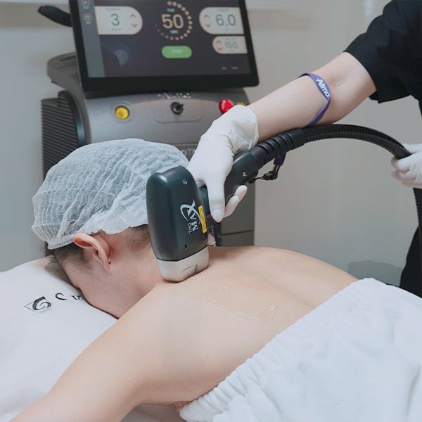 Điều trị da cơ thể