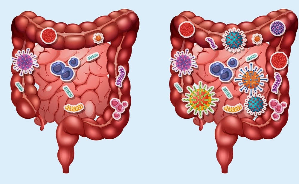 Prebiotics