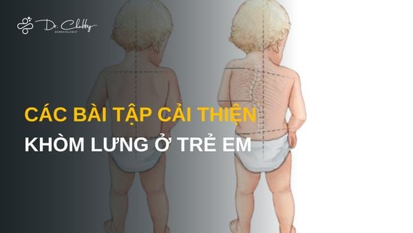 Khòm lưng ở trẻ em: Dấu hiệu nhỏ nhưng có thể ảnh hưởng lớn đến vóc dáng và chiều cao