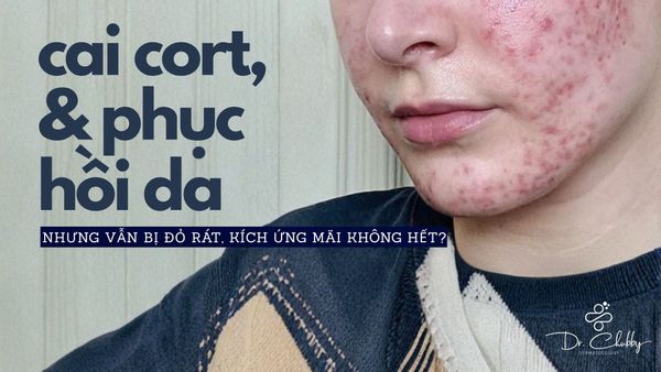 Cai Cort Nhiều Năm Da Vẫn Đỏ Rát? Lý Do Và Cách Phục Hồi