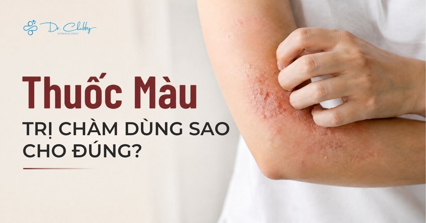 Tắm Thuốc Màu (Đỏ, Xanh) Cho Người Bệnh Chàm Viêm Da Cơ Địa: Khi Nào Nên, Khi Nào Không?