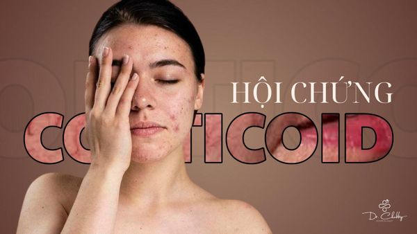 Hội Chứng Cai Corticoid: Dấu Hiệu Nhận Biết Và Giải Pháp Phục Hồi Da An Toàn