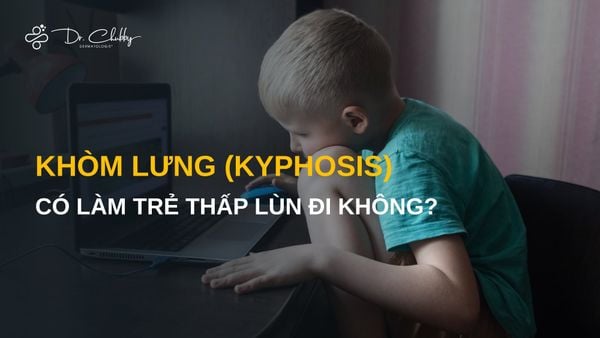 Khòm lưng (Kyphosis) có làm trẻ thấp lùn đi không? Đây là điều ba mẹ cần biết