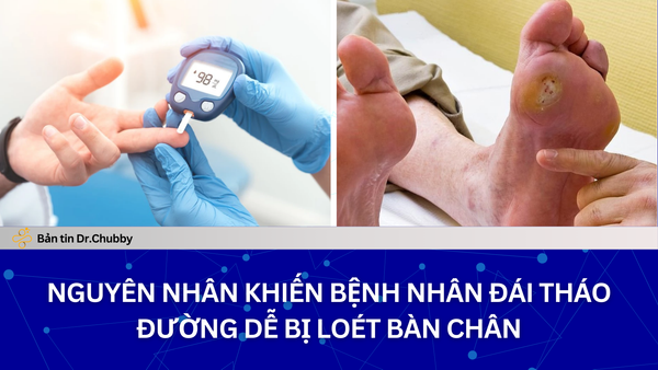 Loét Bàn Chân Đái Tháo Đường: Hiểu Đúng Để Tránh Đoạn Chi