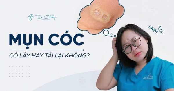 Mụn cóc có lây lan không và có tái đi tái lại không?