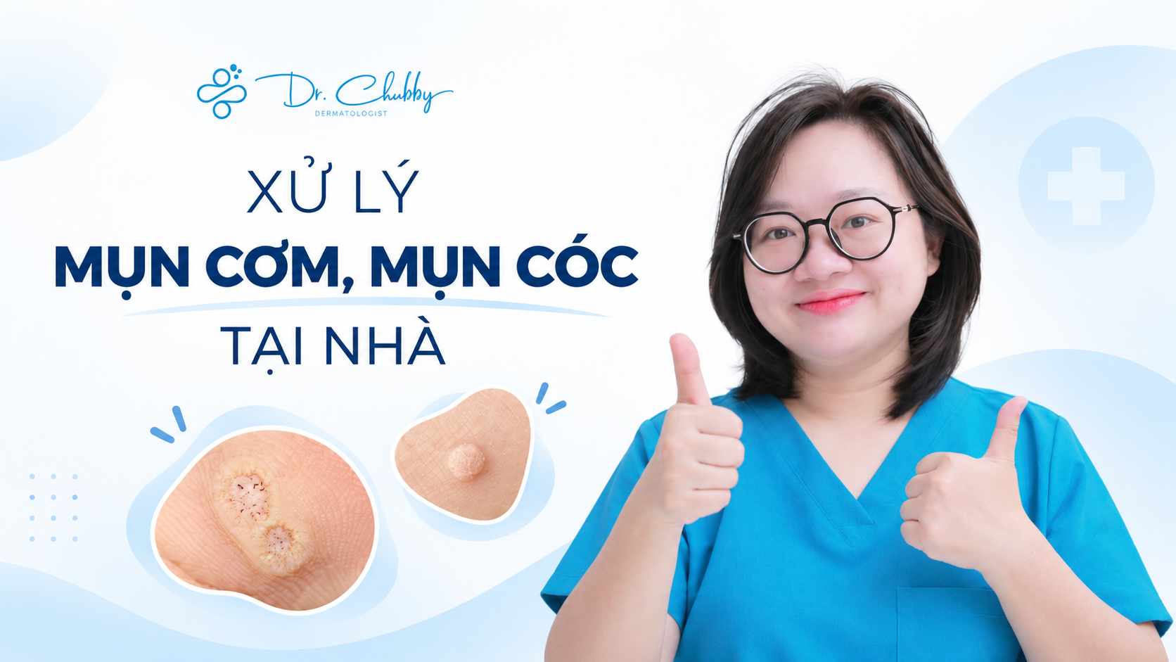 Mụn Cóc Và Mụn Cơm Có Khác Nhau Không? Nguyên Nhân Do HPV Và Cách Xử Lý An Toàn