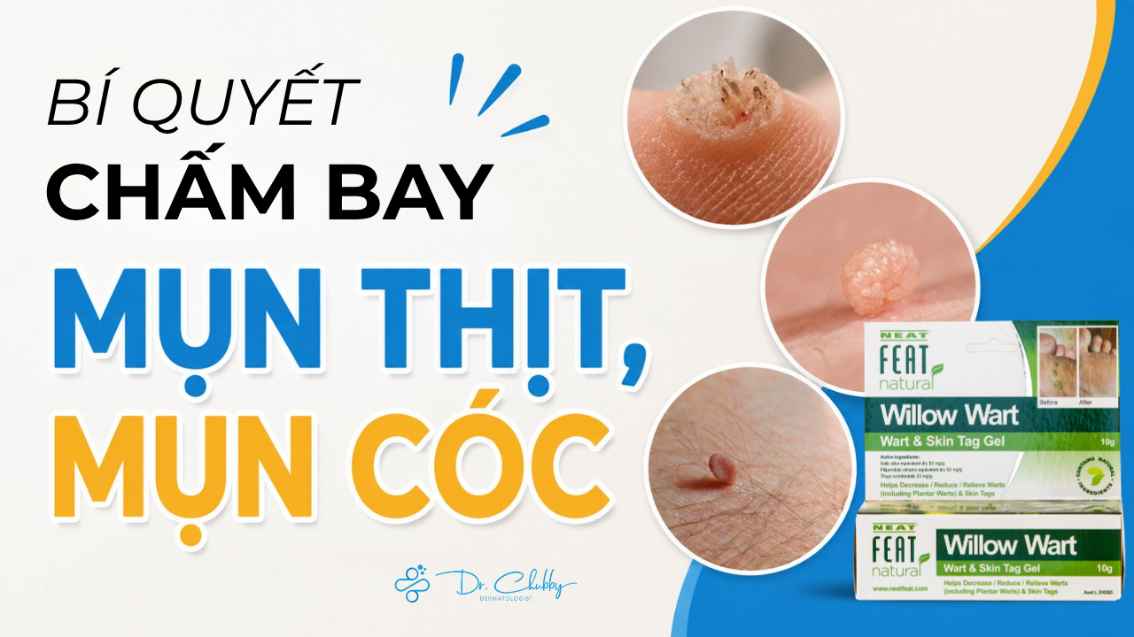 Bí Quyết Xử Lý Mụn Thịt, Mụn Cóc Ngay Tại Nhà