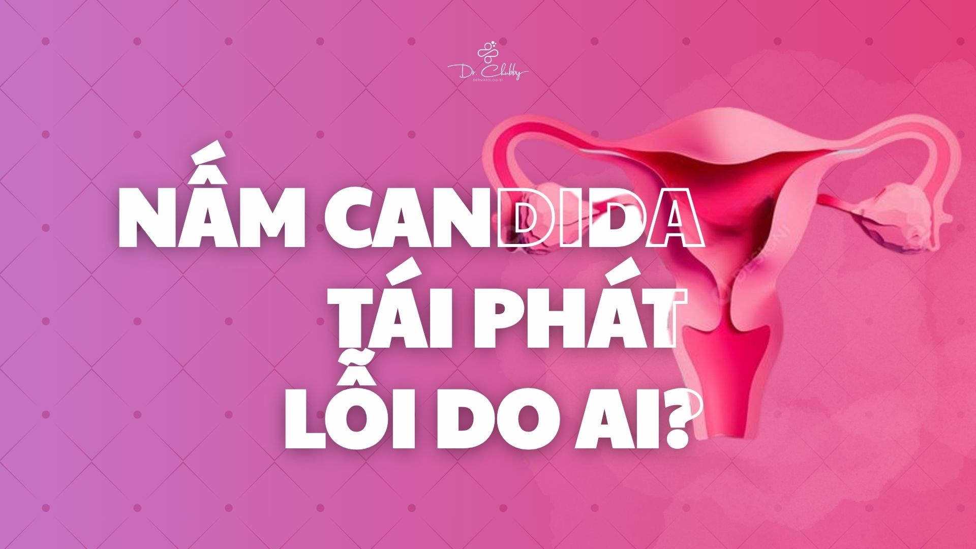 Candida tái phát mãi? Nguyên nhân thật sự và cách trị dứt điểm
